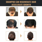 Hair Loss Treatment Shampoo