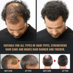 Hair Loss Treatment Shampoo