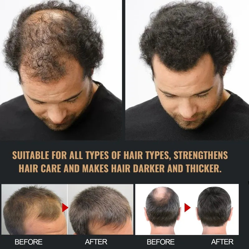 Hair Loss Treatment Shampoo