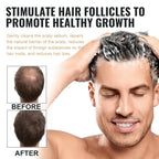 Hair Loss Treatment Shampoo